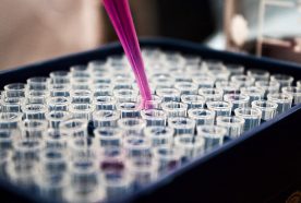 Close up of a pipette filling small vials in a lab