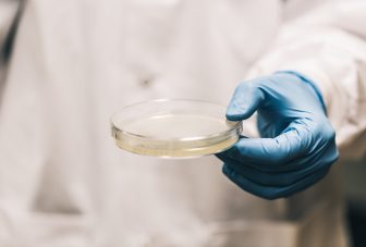 Exploring understudied aspects of antimicrobial resistance